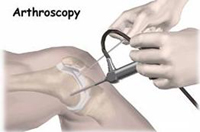 Arthroscopy and sports medicine clinic,SPORTS MEDICINE CLINIC NEW DELHI,NEW DELHI SPORTS MEDICINE,SPORTS MEDICINE SAFDARJUNG,MEDICINE SPORTS DELHI, DELHI SPORTS MEDICINE,ARTHROSCOPY INDIA,NEW DELHI