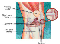 arthroscopy india, arthroscopy delhi,arthroscopy surgery india,arthroscopy surgen india,arthroscopy surgen india,arthroscopy surgery india,arthroscopy surgen delhi,arthroscopy doctors delhi,arthroscopy doctors india,arthroscopy clinic delhi,arthroscopy clinic india,arthroscopy south delhi,arthroscopy north delhi,arthroscopy west delhi,arthroscopy south -ex delhi,arthroscopy joints surgery,arthroscopy patient delhi,arthroscopy patient india,arthroscopy surgen india,arthroscopy surgery delhi,arthroscopy doctors clinic india,arthroscopy south surgen delhi,arthroscopy west delhi,arthroscopy patient india,arthroscopy patitent delhi