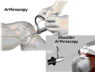 arthroscopy,arthroscopy delhi,arthroscopy india,arthroscopy clinic india,arthroscopy clinic delhi,arthroscopy south delhi,arthroscopy surgery,arthroscopy patient,arthroscopy surgen,arthroscopy north delhi,arthroscopy india doctors,arthroscopy north - west delhi,arthroscopy india surgen,arthroscopy patient delhi,arthroscopy delhi surgery,arthroscopy south -ex surgen,arthroscopy east delhi,arthroscopy surgery india,arthroscopy east-surgen india,arthroscopy indian surgen,arthroscopy joint surgery ,arthroscopy joint surgery india , arthroscopy joint surgery delhi,arthroscopy south - ex surgen india,arthroscopy su